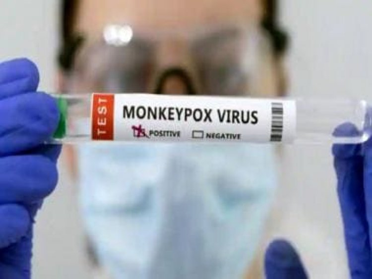 Explained: Why WHO has asked people to reduce sex partners amid monkeypox menace