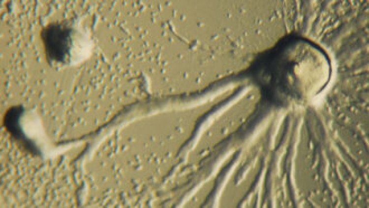 Tiny amoebas move faster when carrying cargo than without