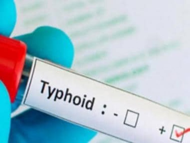 Typhoid treatment: Five home remedies to deal with it