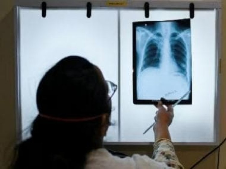 India Rejects J&amp;J Plea to Extend Patent on Key Tuberculosis Drug, Drop in Prices Expected