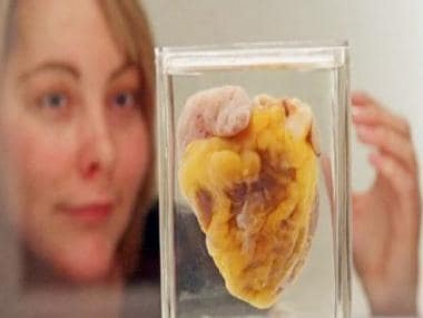 Woman sees own heart in a museum, 16 years after her life-saving surgery