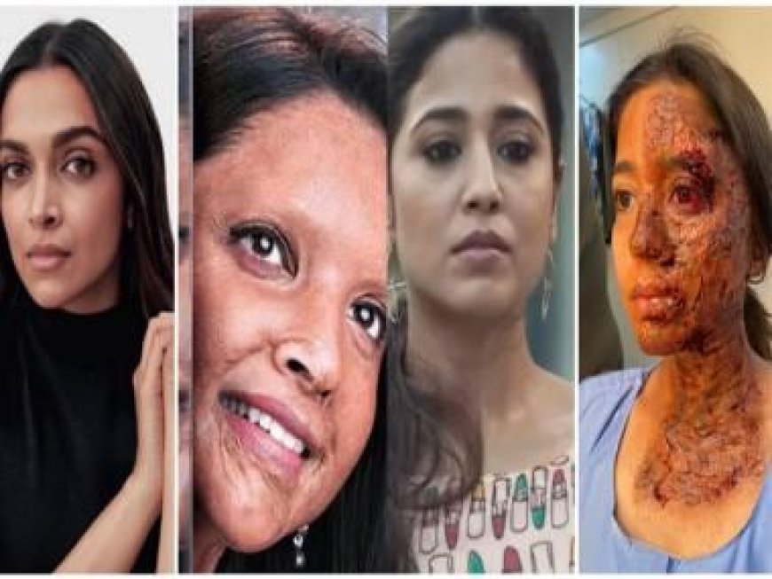 From Deepika Padukone to Shweta Tripathi Sharma, actresses that have essayed the role of acid attack survivors