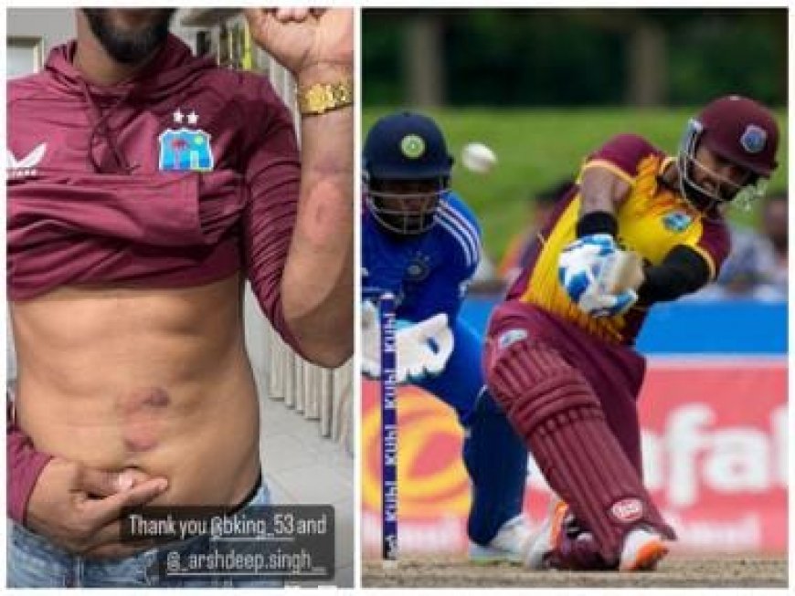 Nicholas Pooran shares photo of his bruised abdomen, forearm, 'thanks' Arshdeep Singh and Brandon King