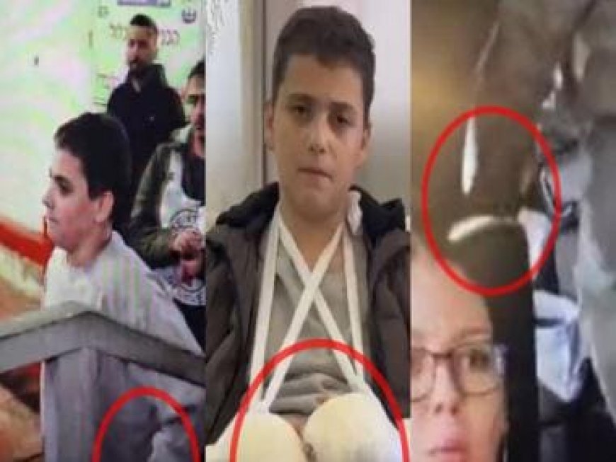 WATCH Hamas shenanigans smashed: Teen 'terrorist' freed by Israel wears false cast on hands, caught lying on camera