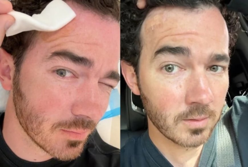 Priyanka Chopra’s Brother-In-Law Kevin Jonas Diagnosed With Skin Cancer, Undergoes Treatment – Watch