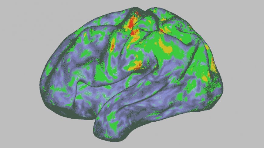 Psilocybin temporarily dissolves brain networks