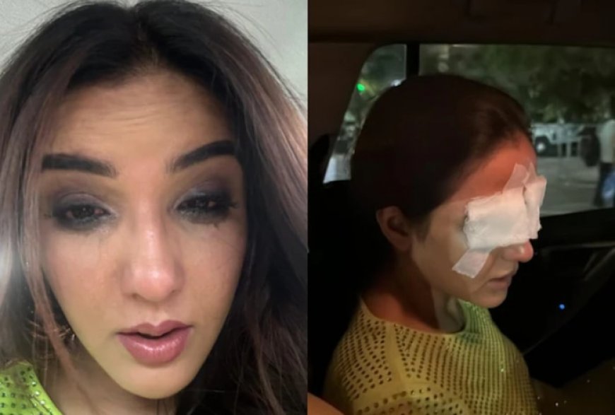 Jasmin Bhasin Reveals Lens Mishap Damaged Her Corneas, Says ‘I am in a Lot of Pain’