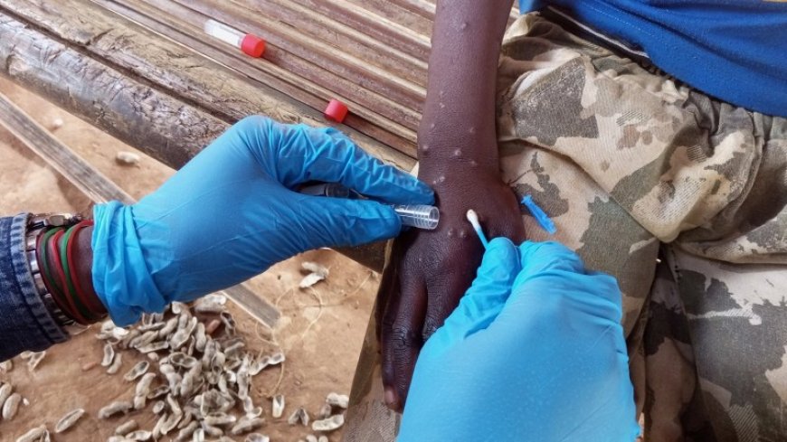 Why mpox is a global health emergency — again