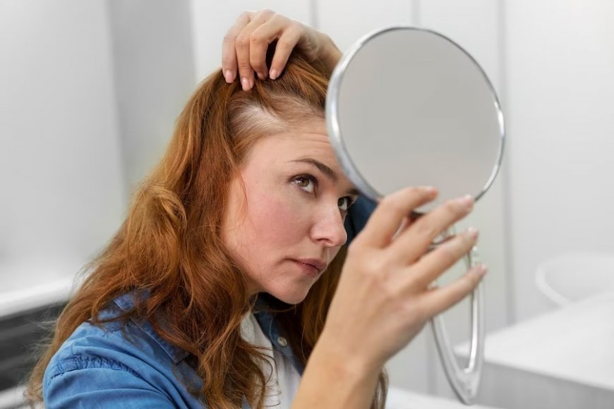 PCOS Hair Loss: Advanced Treatment Options to Restore Thinning And Boost Healthy Locks